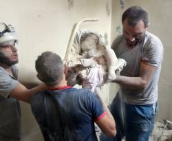 أشلاء في شوارع حلب، والأطباء عاجزون في مشافيها